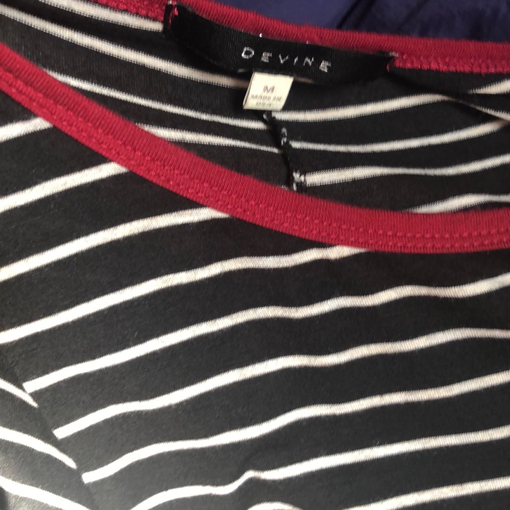 Striped Button Sleeve Dress - Picture 8 of 8